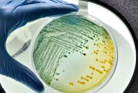 Pencemaran yang Disebabkan Oleh Bakteri E. Coli Dinamakan?